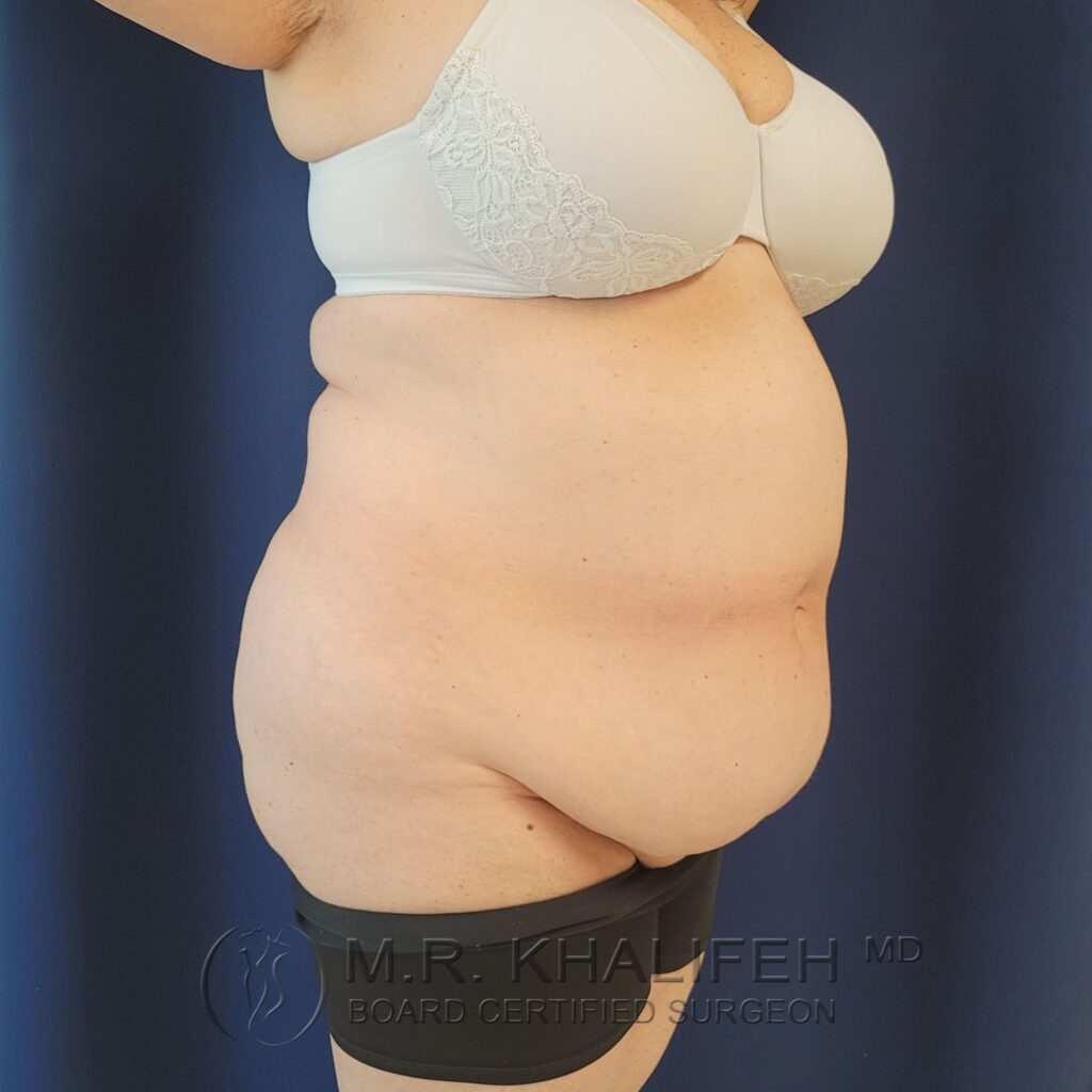 Xr:d:DAFQQVXOIyk:2,j:39259627177,t:22102717