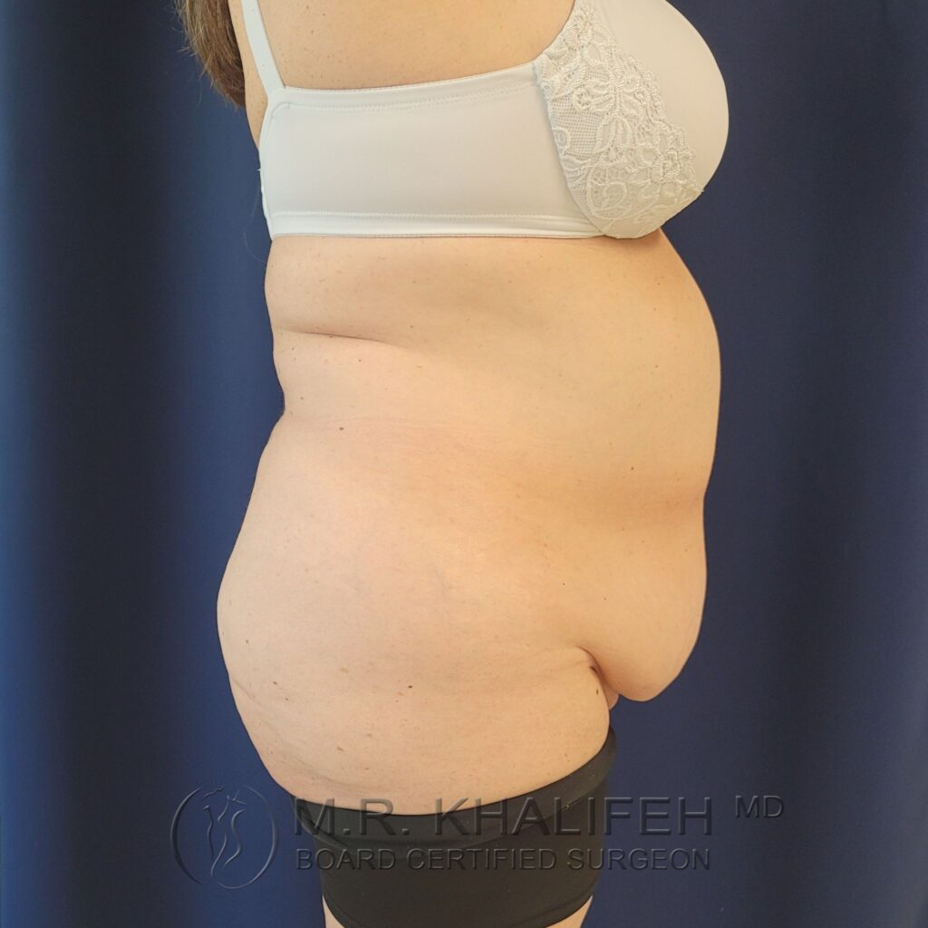 Xr:d:DAFQQWAAaAQ:2,j:39259591782,t:22102717