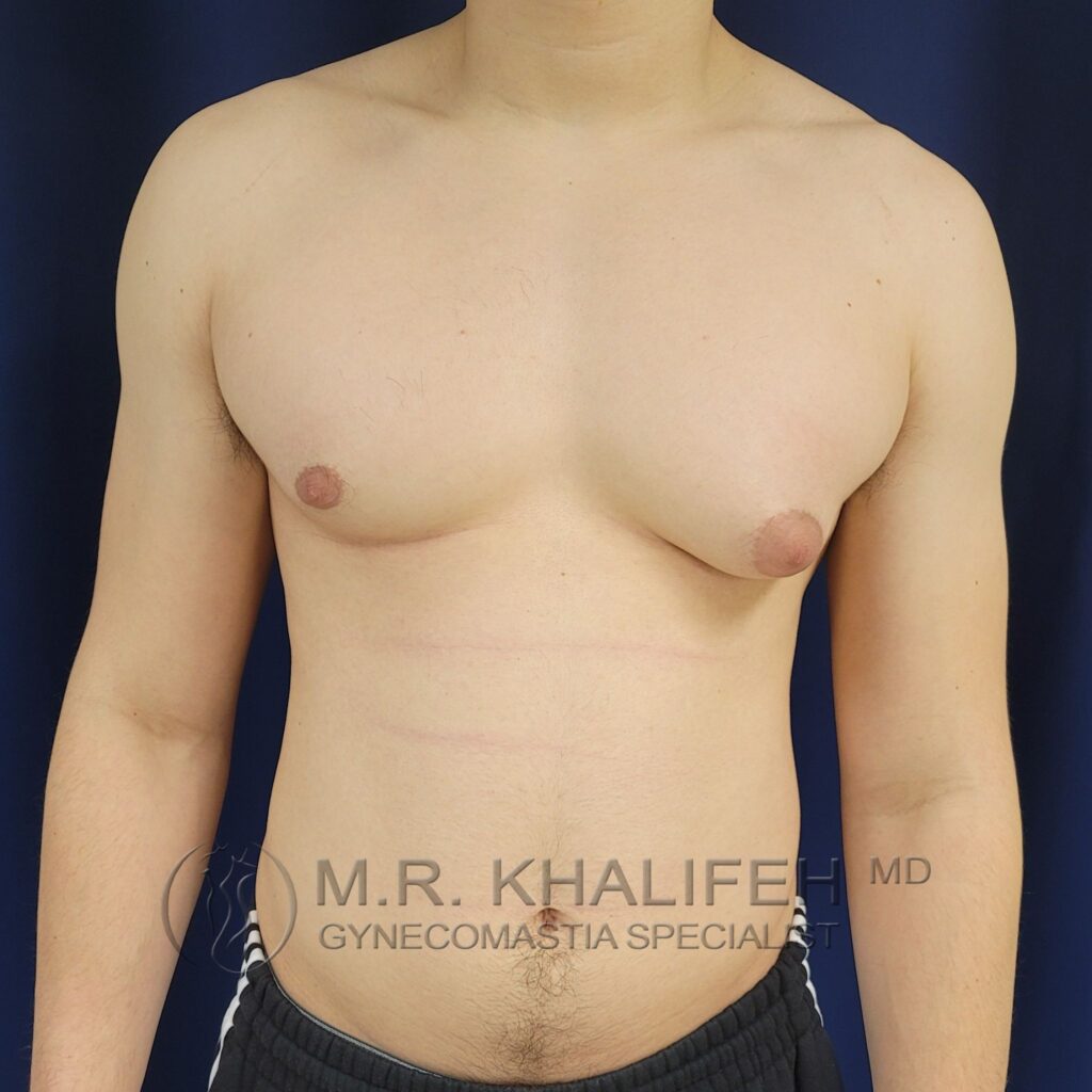 Xr:d:DAFYNt5 Ovs:3,j:2262257139,t:23012014