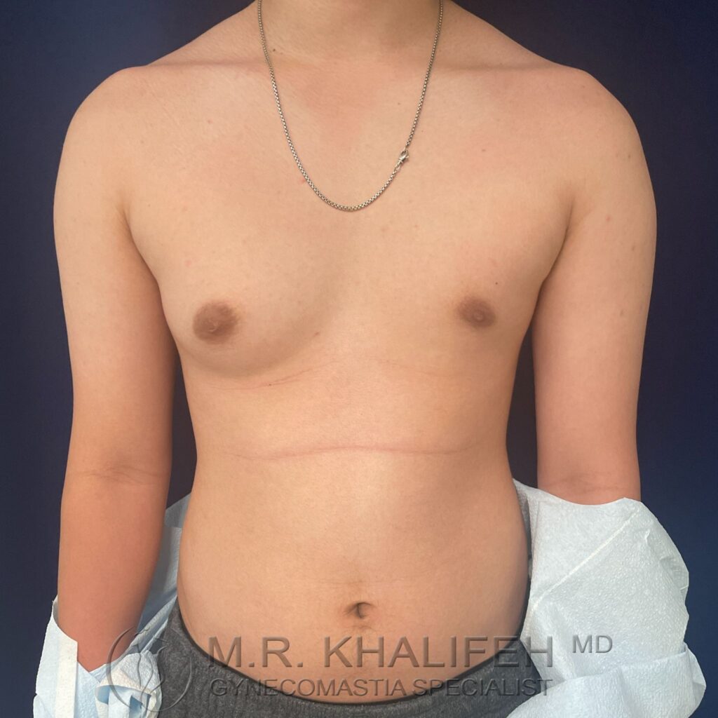 Xr:d:DAFV i24L5s:3,j:1042485133,t:22122718