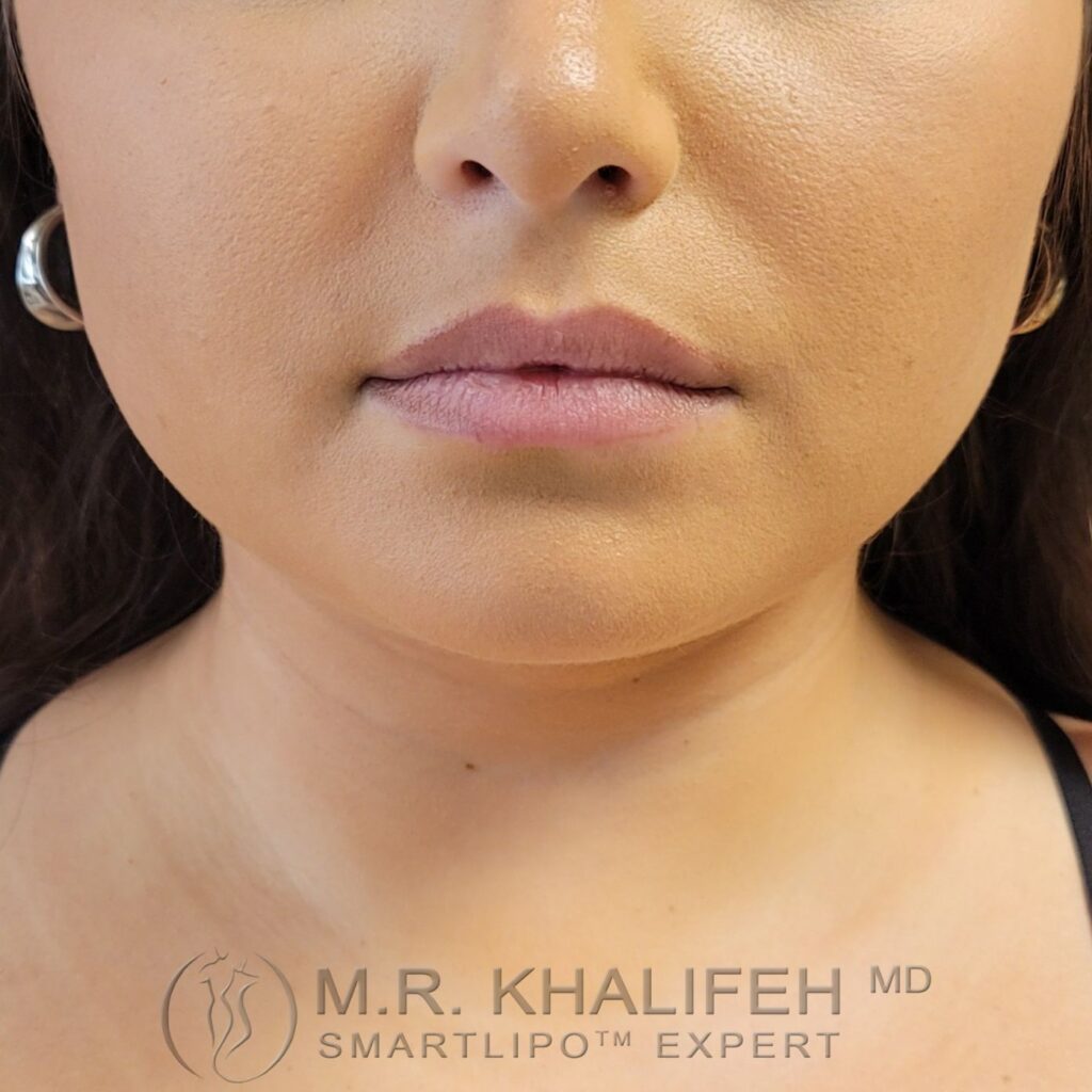 Xr:d:DAFVT3JBWOU:3,j:721839348,t:22122015