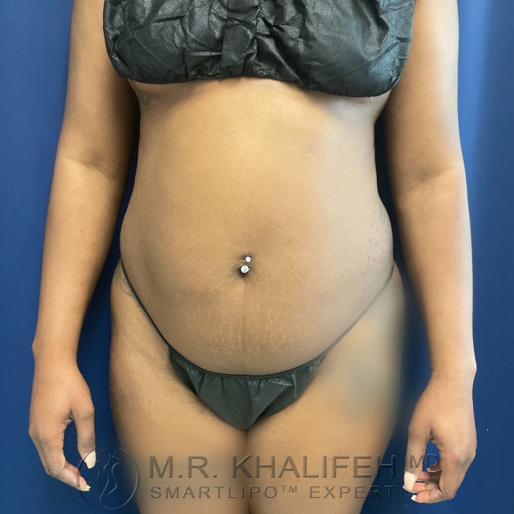 Xr:d:DAFVOaTnVeE:3,j:673326096,t:22121917