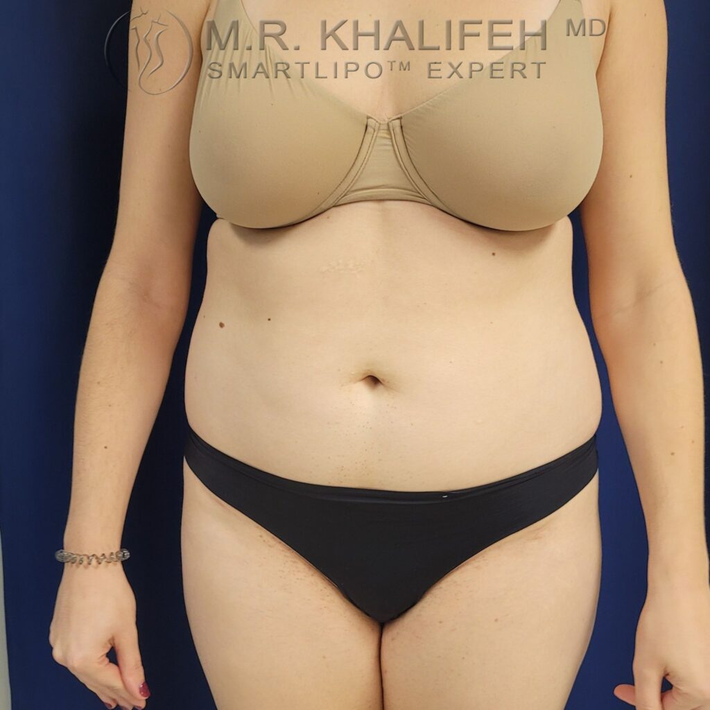 Xr:d:DAFV 4RGtjc:3,j:44283898766,t:22122719