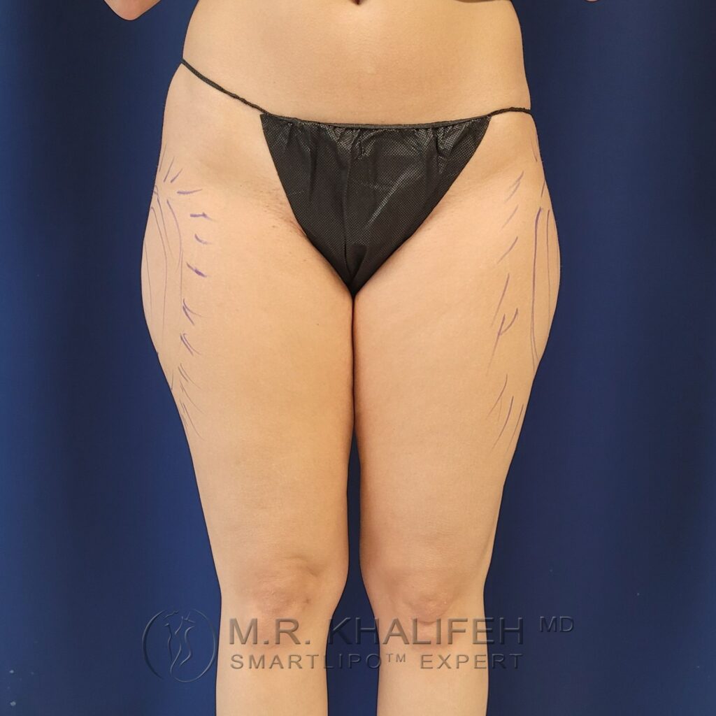 Xr:d:DAFYfpr3Oho:3,j:2399739401,t:23012314