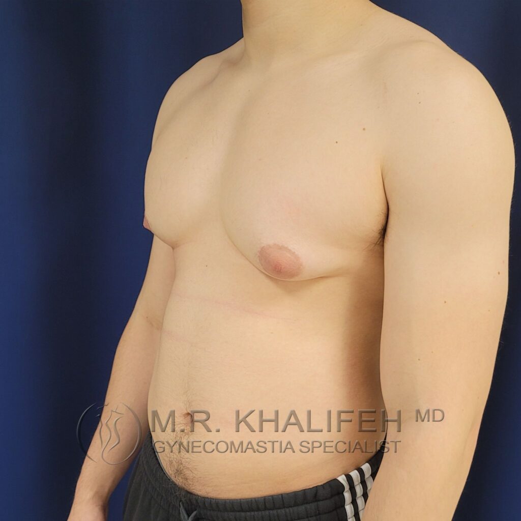 Xr:d:DAFYNXED34c:3,j:2262252544,t:23012014