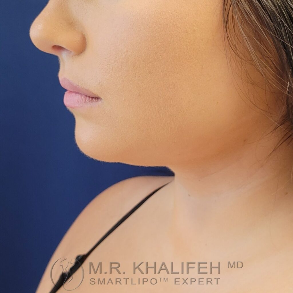 Xr:d:DAFVT3wdJt4:3,j:43951842018,t:22122015