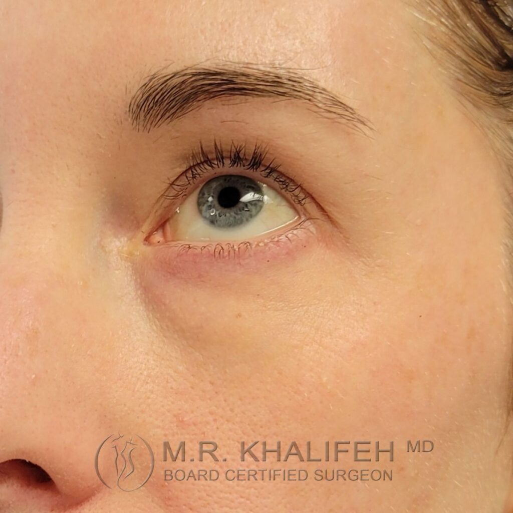 Xr:d:DAFU7vy9CCg:2,j:546260635,t:22121615