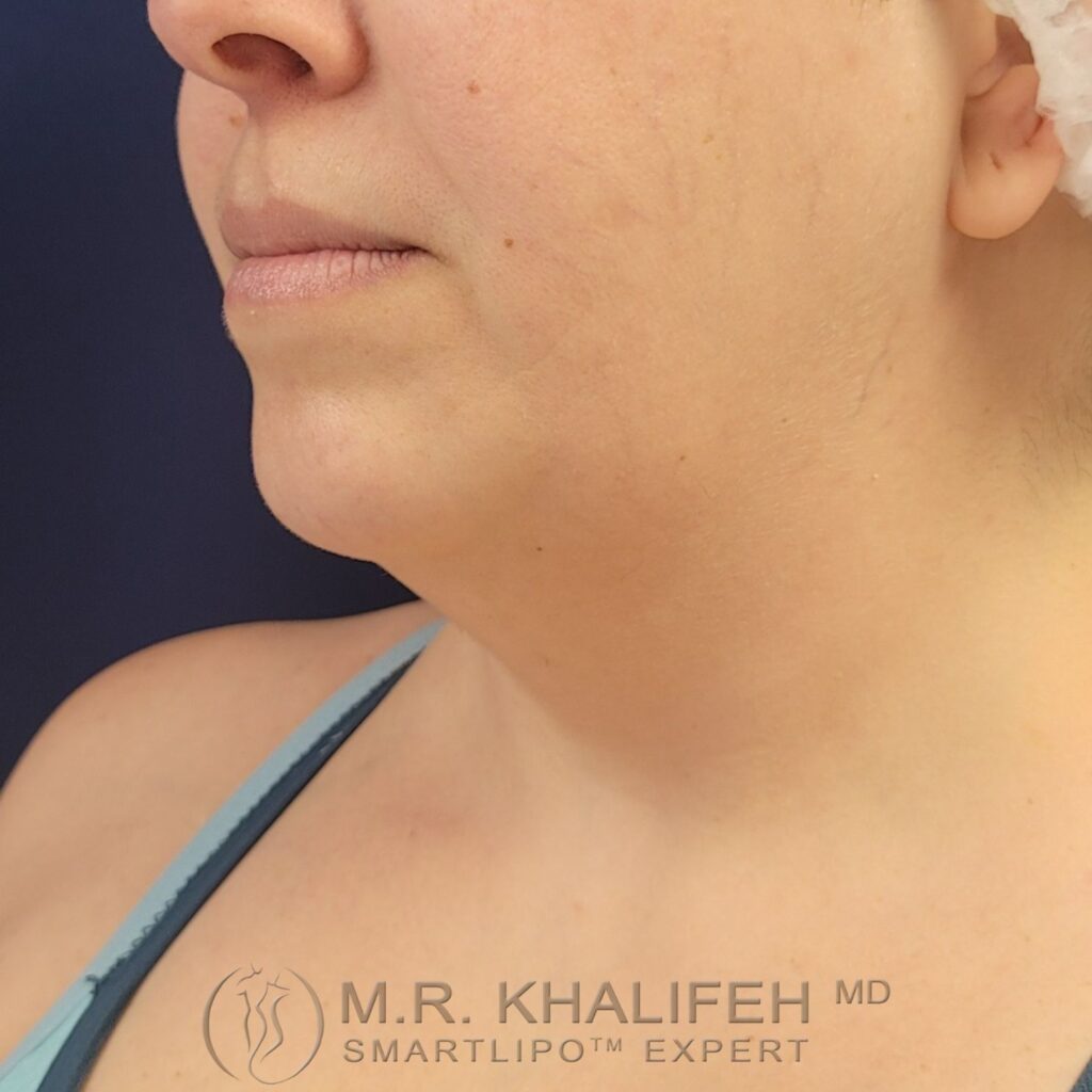 Xr:d:DAFWJgCbM A:3,j:1120134442,t:22122915