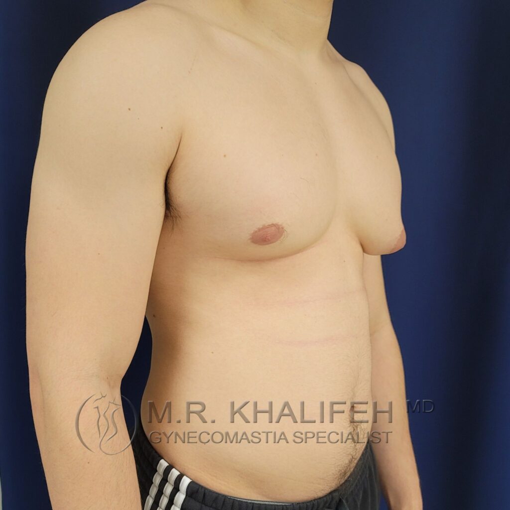 Xr:d:DAFYNml15ZM:3,j:45539190998,t:23012014