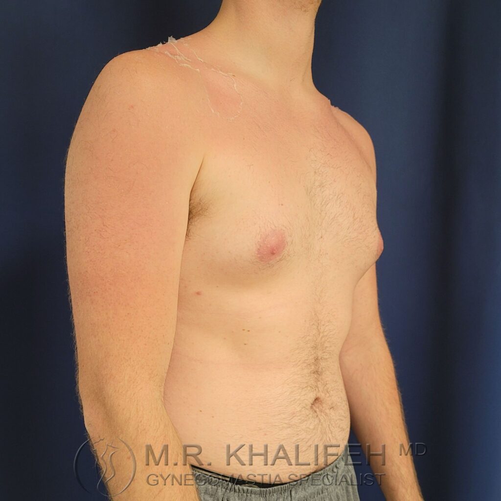 Xr:d:DAFWnweflfI:3,j:44588042588,t:23010315