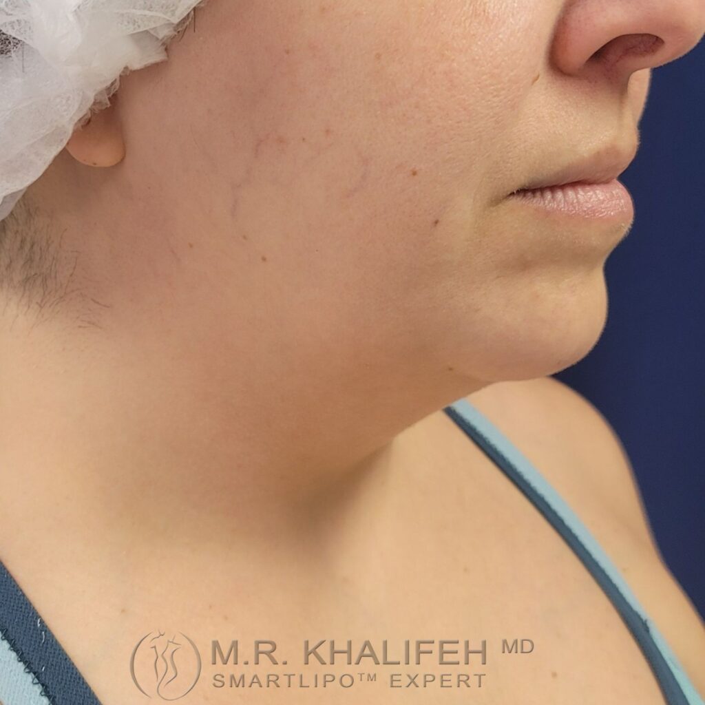 Xr:d:DAFWJvLfxKA:3,j:44363315239,t:22122915