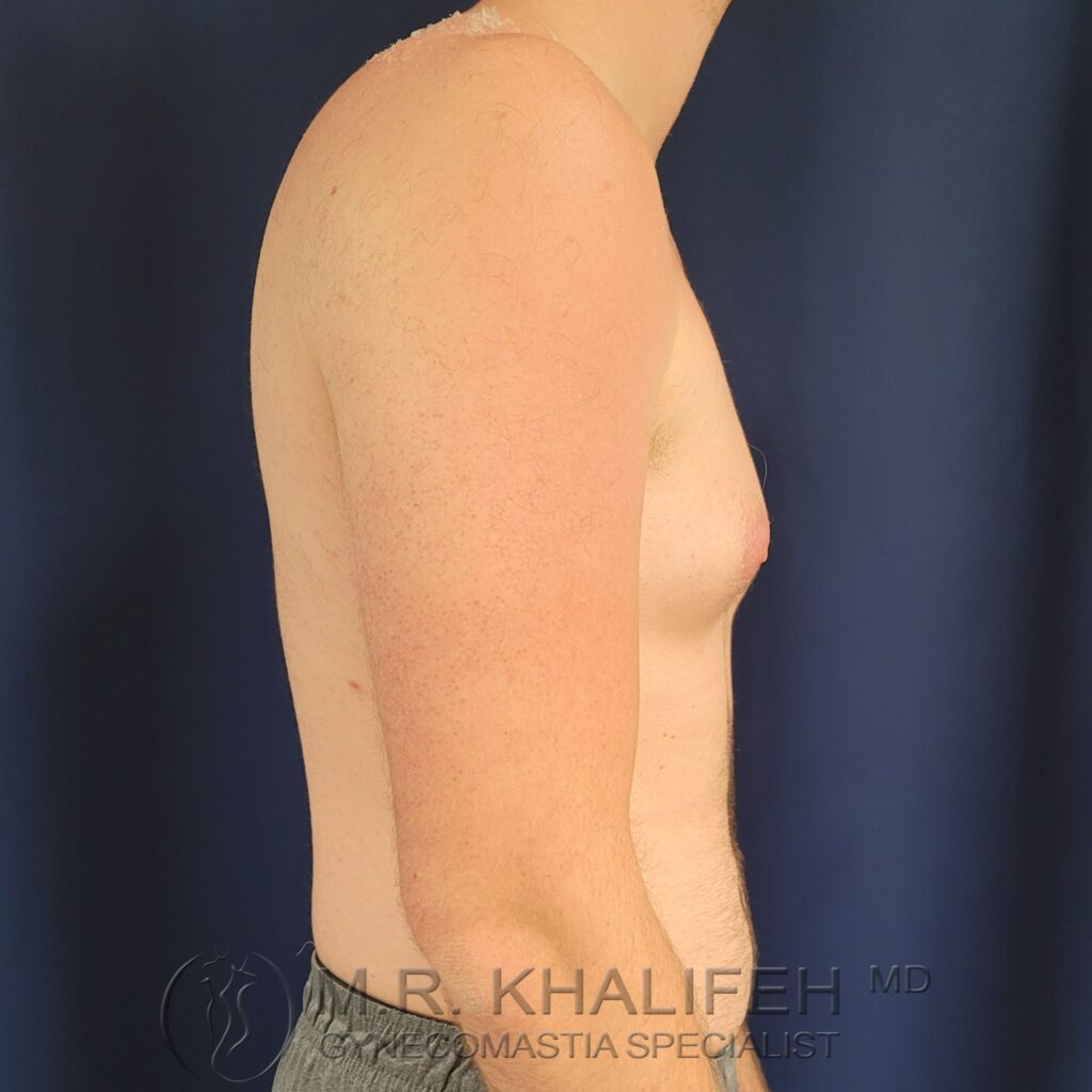 Xr:d:DAFWn Yonlc:3,j:44588028678,t:23010315